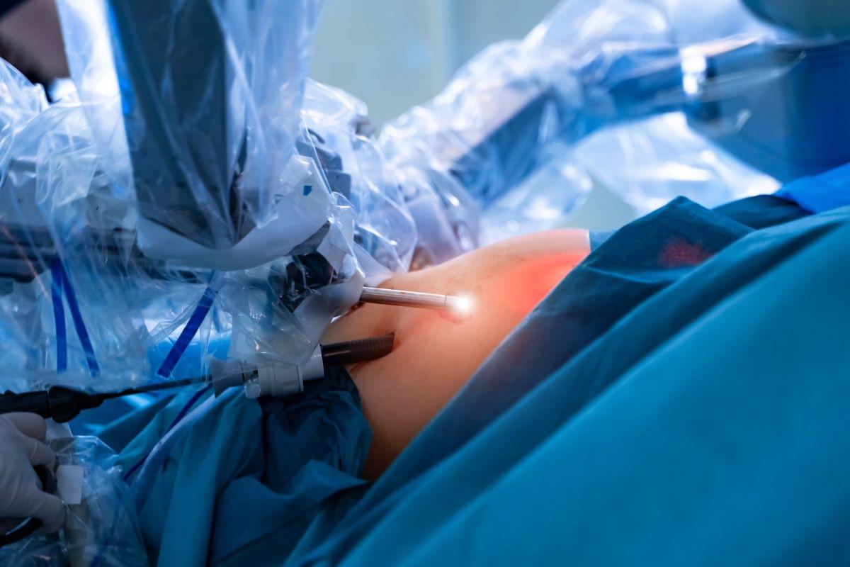 Conheça os tipos de cirurgia bariátrica e quem pode fazer - Reprodução Canva